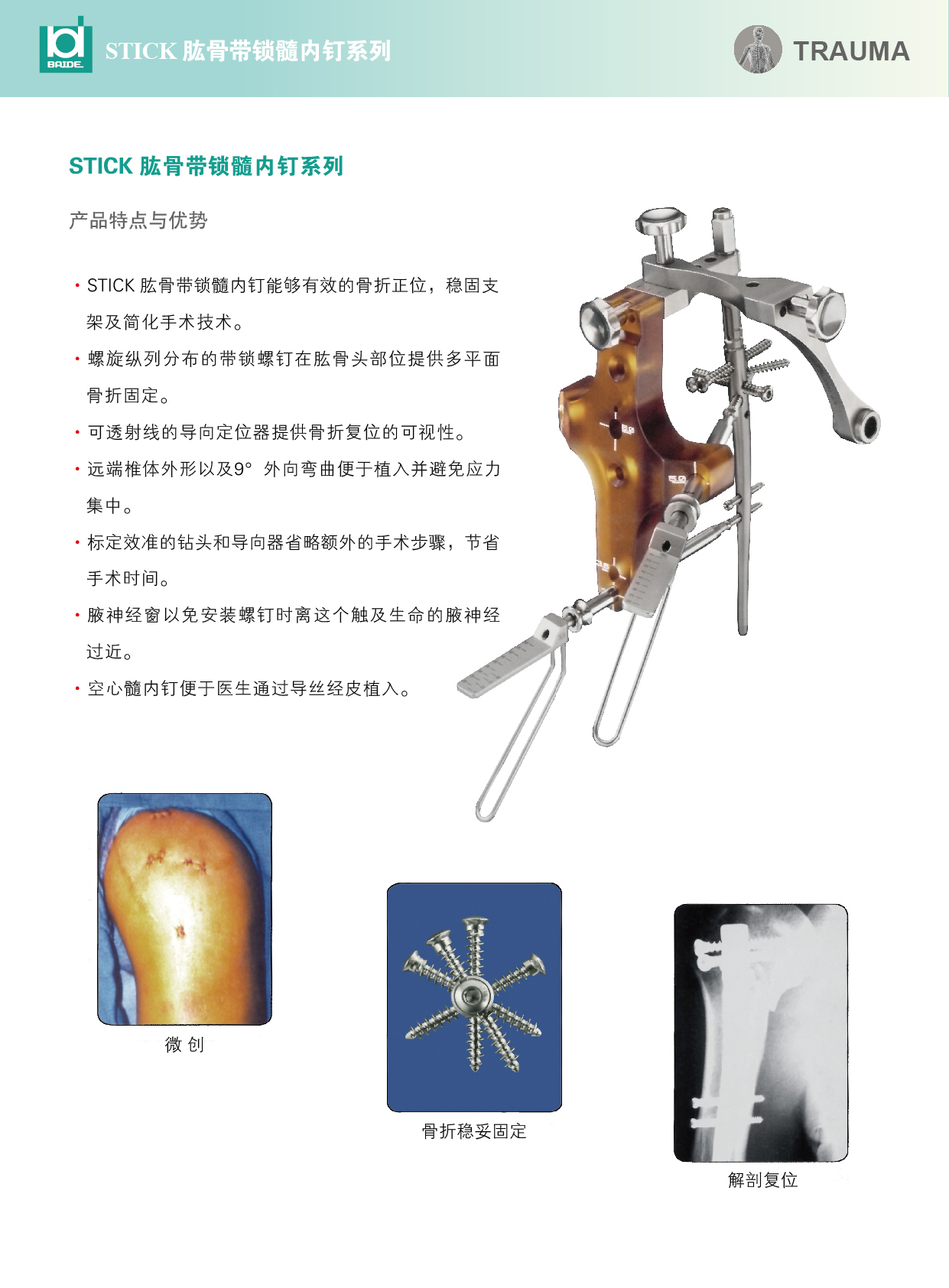 肱骨髓内钉 - 江苏百易得医疗科技有限公司|骨科基础